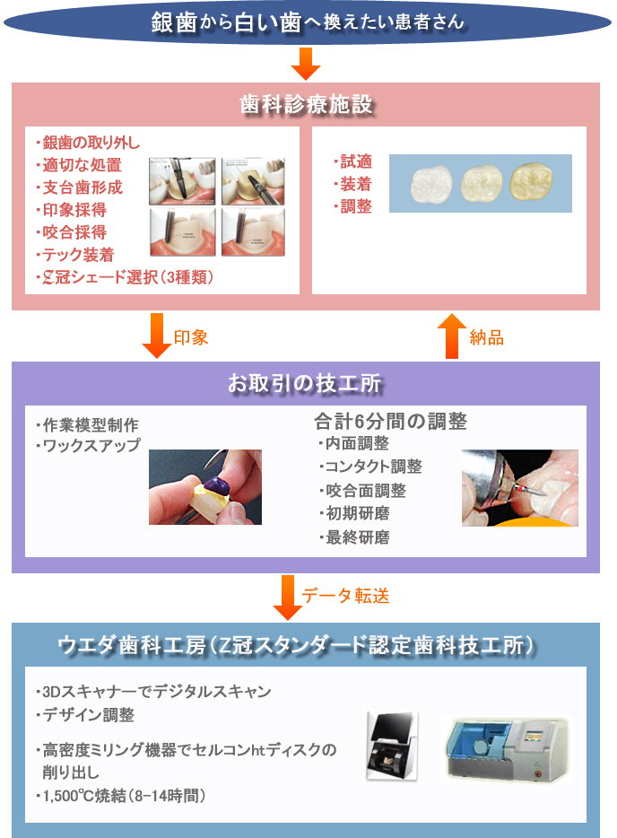 オーダーフロー（ジルコニアの場合）