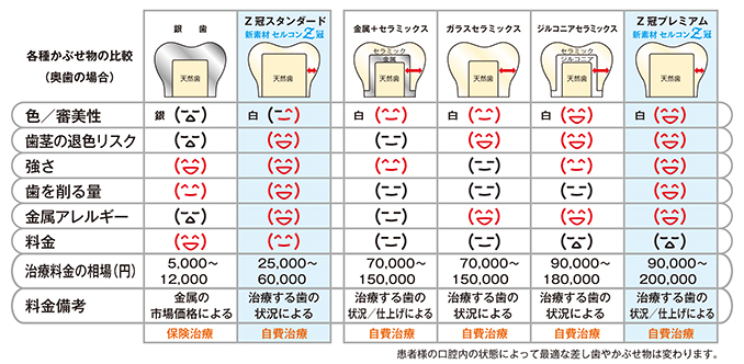 各種かぶせ物の比較